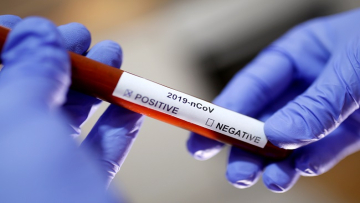 FILE PHOTO: Test tube with Corona virus name label is seen in this illustration taken on January 29, 2020. REUTERS/Dado Ruvic/File Photo